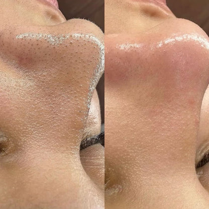 Poros limpos, pele lisa e brilho natural em minutos!